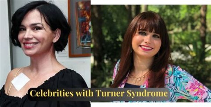 Celebrities With Turner Syndrome And Their Inspiring Journeys