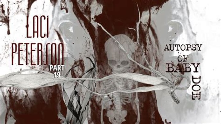 Discoveries From The Treviso Baby Autopsy