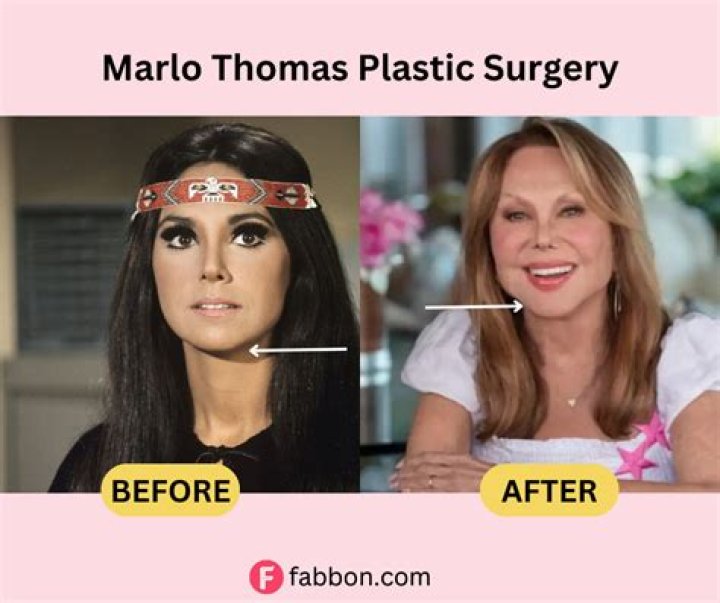 Get The Scoop: Marlo Thomas Surgery Details Revealed