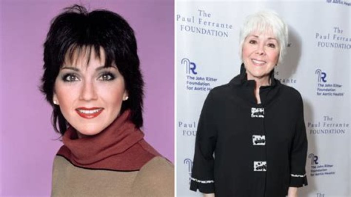 Marlo Thomas' Journey To A New Nose: Uncovering The Truth Behind Her Surgery