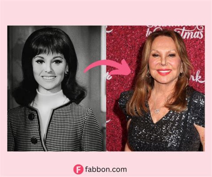 Marlo Thomas: A Guide To Her Cosmetic Surgery Journey