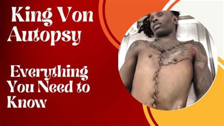 Shocking Autopsy Photo Of King Von Revealed: The Tragic Aftermath