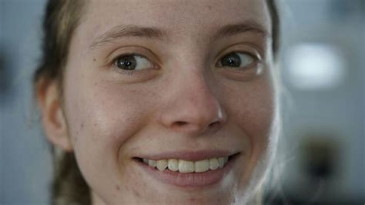 Taylor Breesey's Face Reveal And Its Empowering Impact