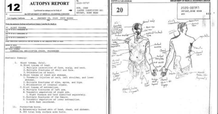 The Tragic Autopsy Report: Unveiling The Demise Of Gianna Bryant