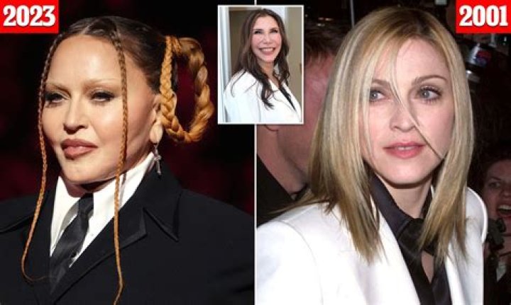 Unveiling The Secrets Behind Antonio Garza's Plastic Surgery Journey