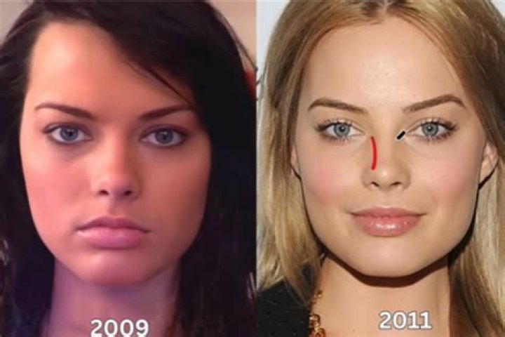 Unveiling The Secrets Of Plastic Surgery: Before And After SB19