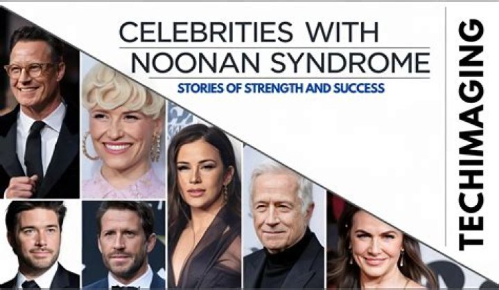 Unveiling The Strength And Success Of Turner Syndrome Celebrities